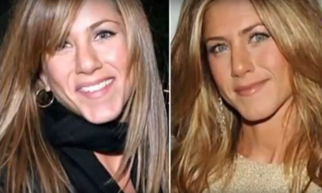 Jennifer Aniston Plastic Surgery - Before and After - Plastic Surgery Facts