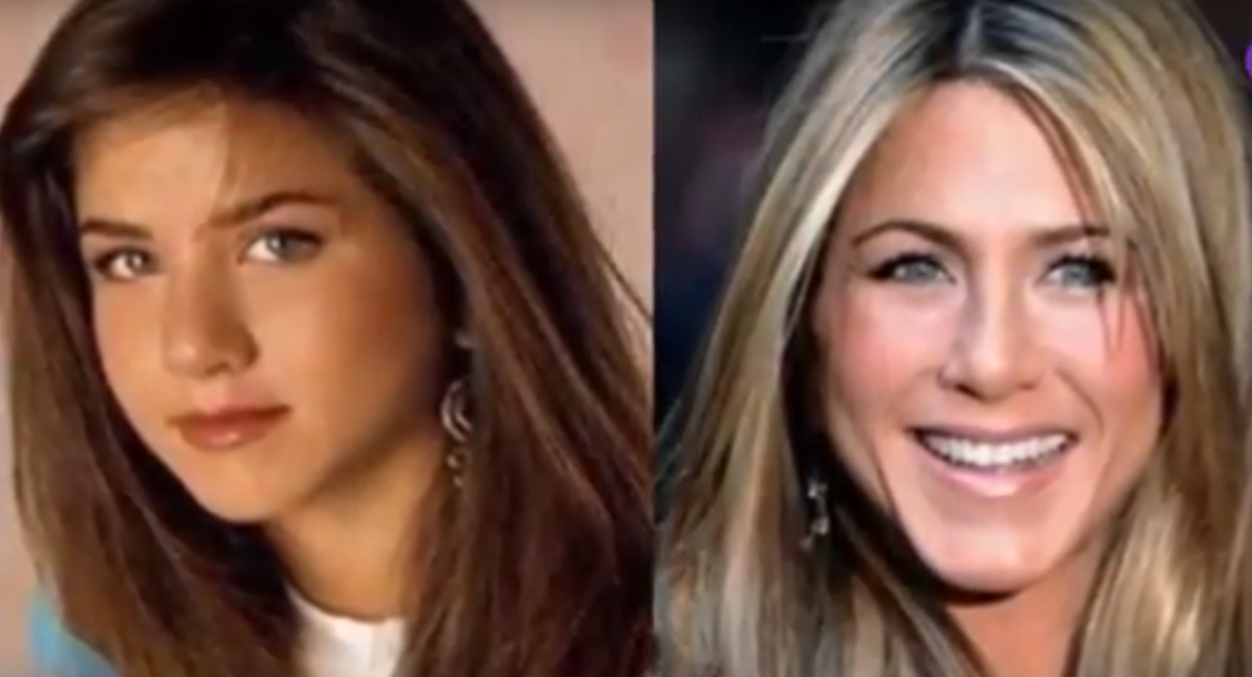 Jennifer Aniston Plastic Surgery - Before and After - Plastic Surgery Facts