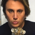 Jonathan Cheban plastic surgery pic 6
