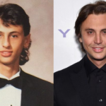 jonathan cheban plastic surgery