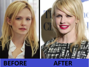 Kathryn Morris Plastic Surgery before and after Archives - Plastic ...