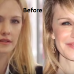 Megyn Kelly Plastic Surgery Before and After - Plastic Surgery Facts