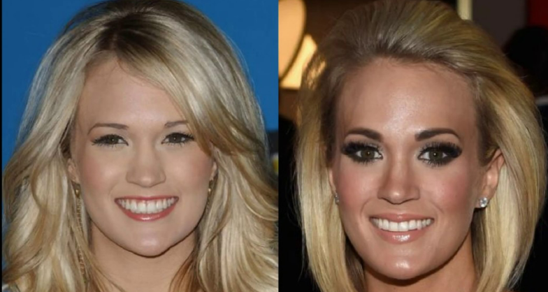 Carrie Underwood's Journey: Embracing Change Through Surgery