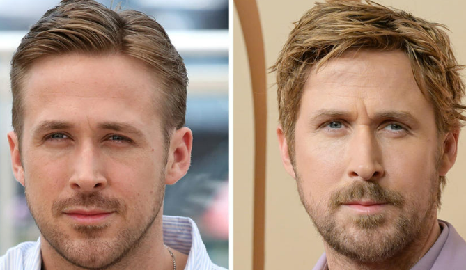 Expert Opinions on Ryan Gosling's Plastic Surgery Rumors