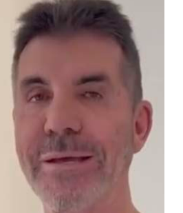 Public Reaction to Simon Cowell's Plastic Surgery Journey