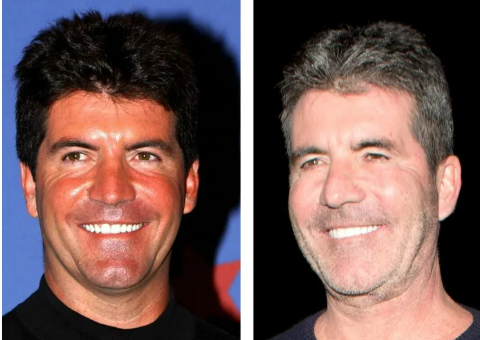 Understanding Simon Cowell's Evolving Appearance Over the Years