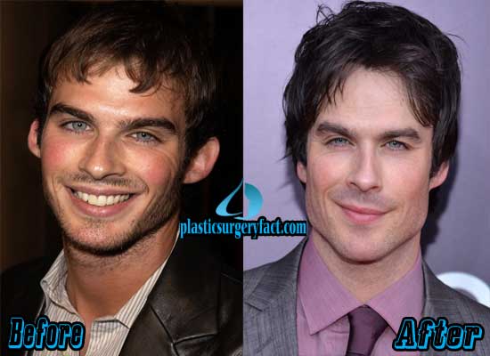 Fan Theories on Ian Somerhalder's Possible Cosmetic Enhancements