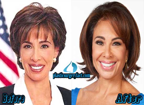 What Procedures Did Jeanine Pirro Undergo? A Detailed Overview