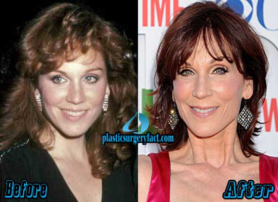 The Transformation: Marilu Henner's Before and After Photos
