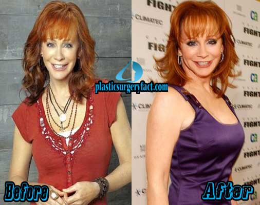 Analyzing Reba McEntire's Evolving Look Over the Years